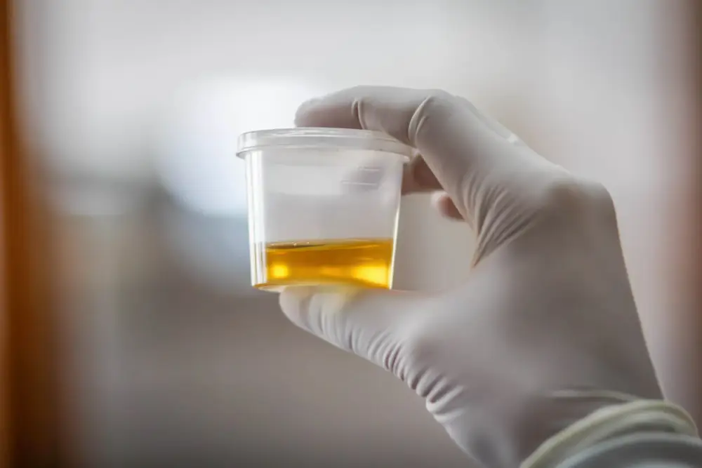 kratom urine drug test